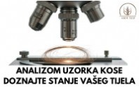 Analizom uzorka kose doznajte stanje vašeg tijela