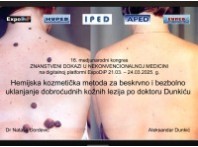 HEMIJSKA KOZMETIČKA METODA ZA UKLANJANJE MLADEŽA PO DOKTORU DUNKIĆU